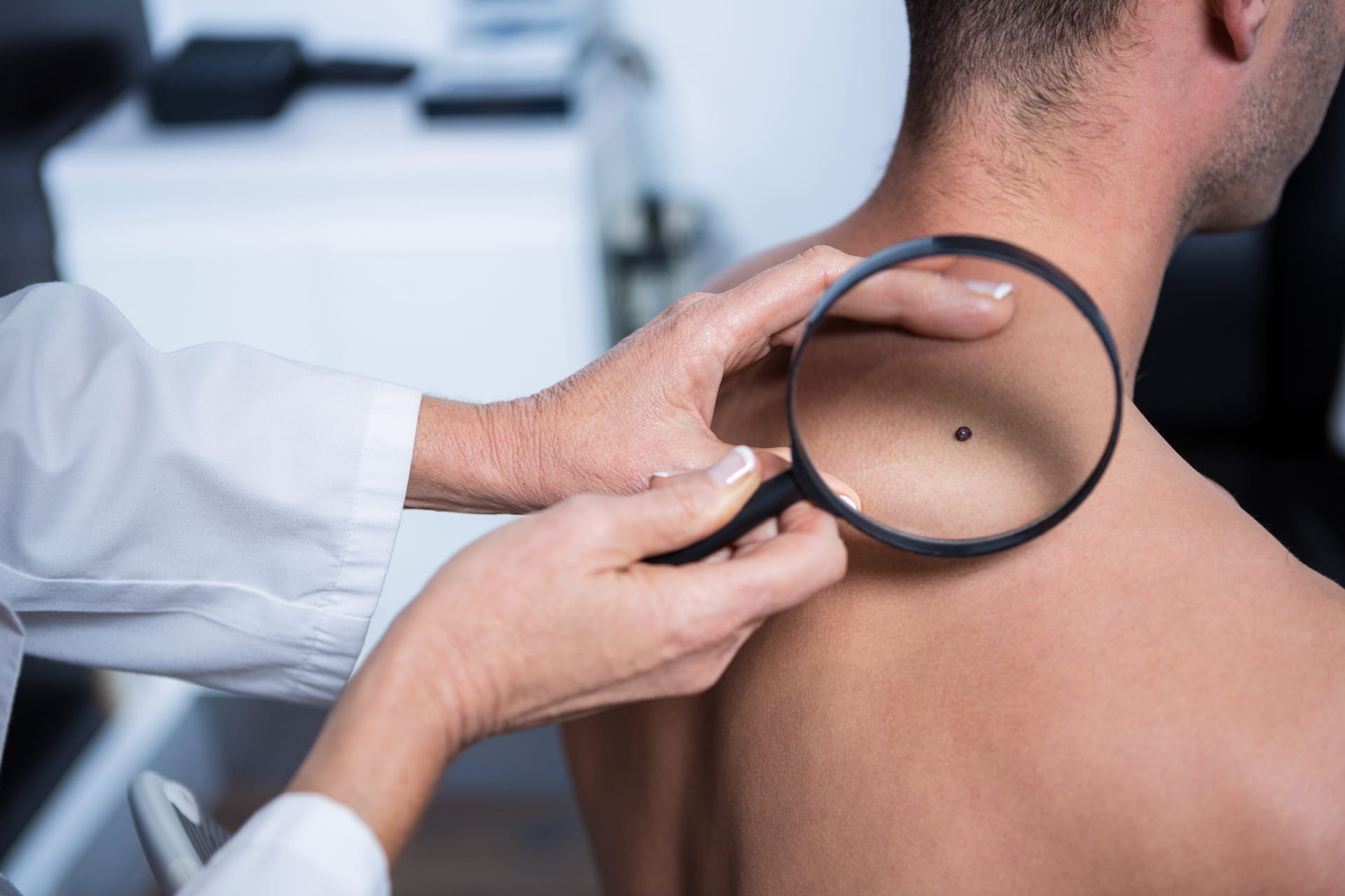 Patient with a doctor looking at mole on back